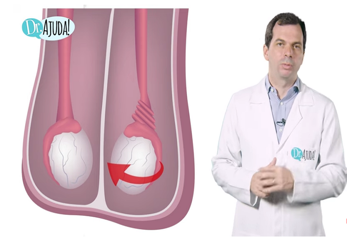 Sintomas de dor no testículo.Veja o vídeo com a explicação do ...